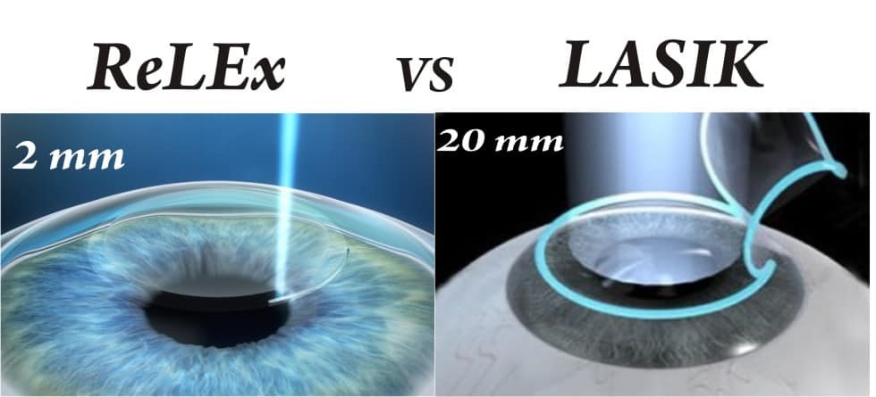 smile surgery cost