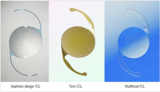 IOL Lens Implant