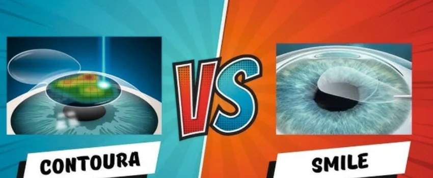 contoura vs lasik